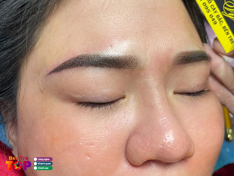 tham-my-hien-vy-bentretoplist