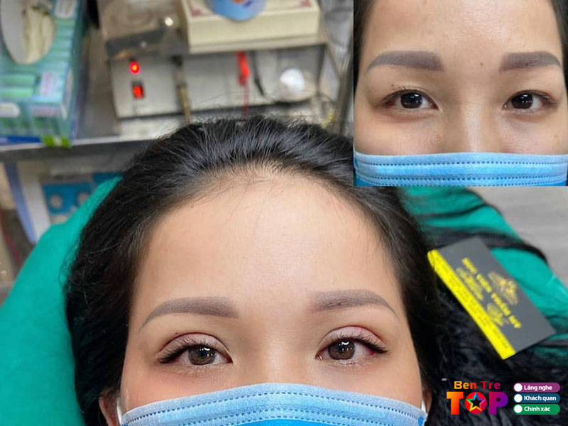 tham-my-hien-vy-bentretoplist