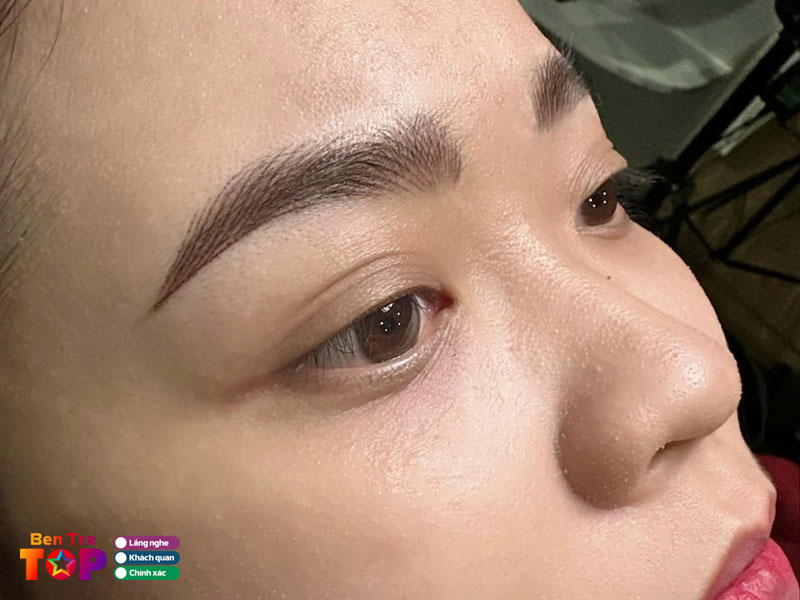 tham-my-vien-thanh-nga-bentretoplist