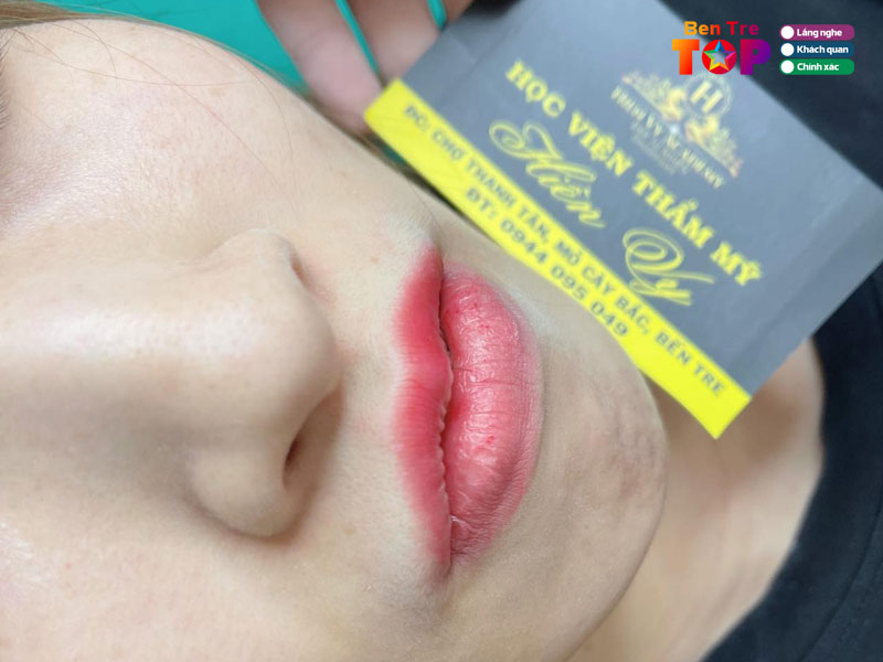 Tham-my-hien-vy-bentretoplist