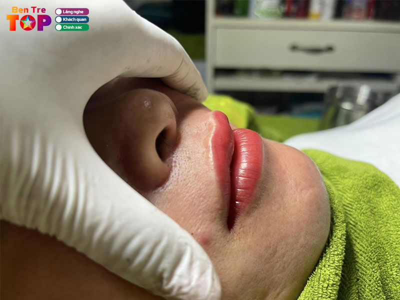 Vuy-beauty-spa-bentretoplist