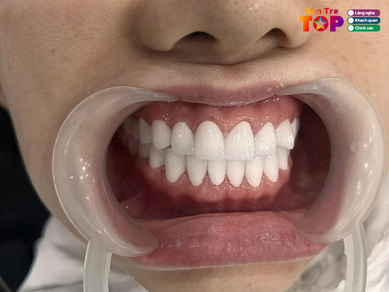 Nha-khoa-toan-y-bentretoplist