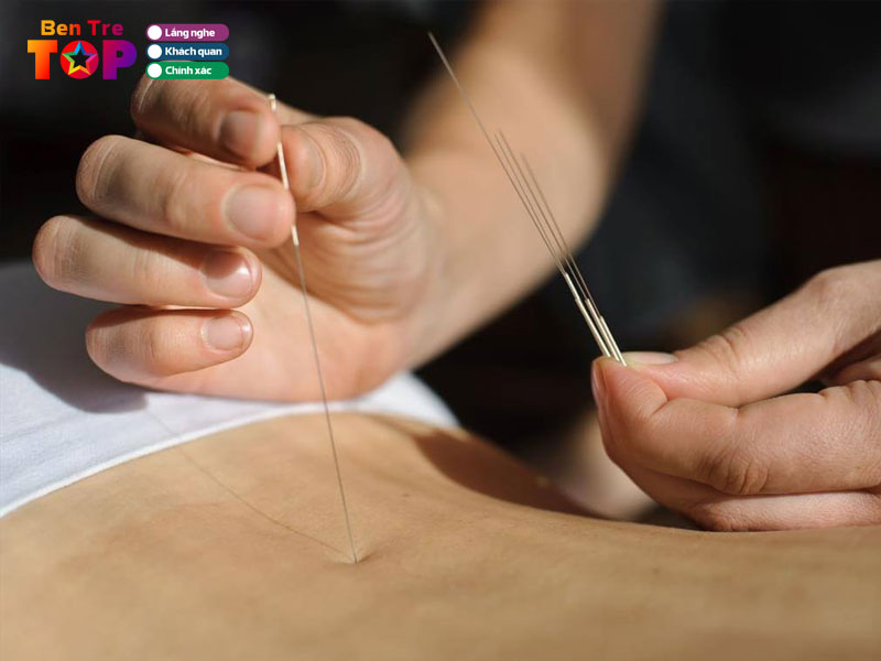 Phong-chan-tri-dai-phuc-bentretoplist