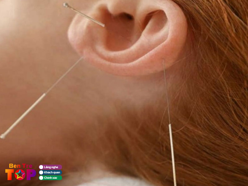 Phong-chan-tri-y-hoc-co-truyen-bs-minh-bentretoplist