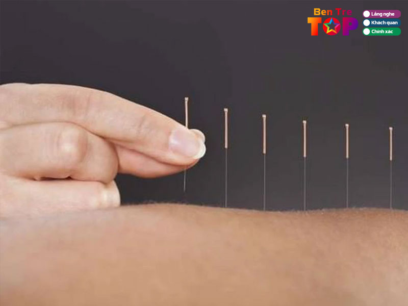 Phong-chan-tri-y-hoc-co-truyen-tu-nhan-bac-si-le-thi-dung-bentretoplist