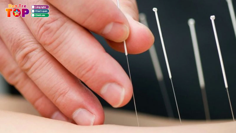 Top-6-dia-diem-cham-cuu-o-ben-tre-xua-tan-con-dau-nhuc-bentretoplist